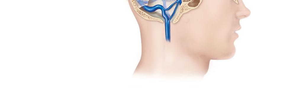 Falx cerebri Inferior sagittal sinus Cavernous sinus Straight sinus Confluence