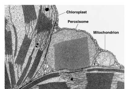 13. Microbodies Various organelles which regulate different metabolic reactions such