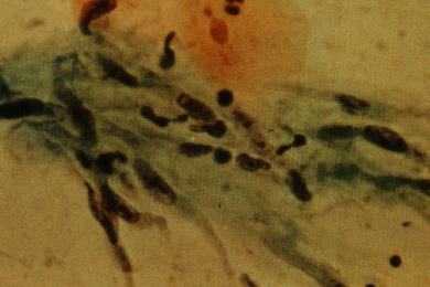 Exfoliative cytology Picture of healthy