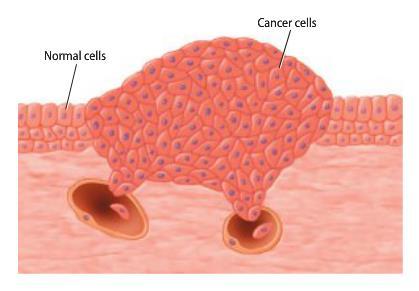 Control of the Cell Cycle Groups of cancer cells