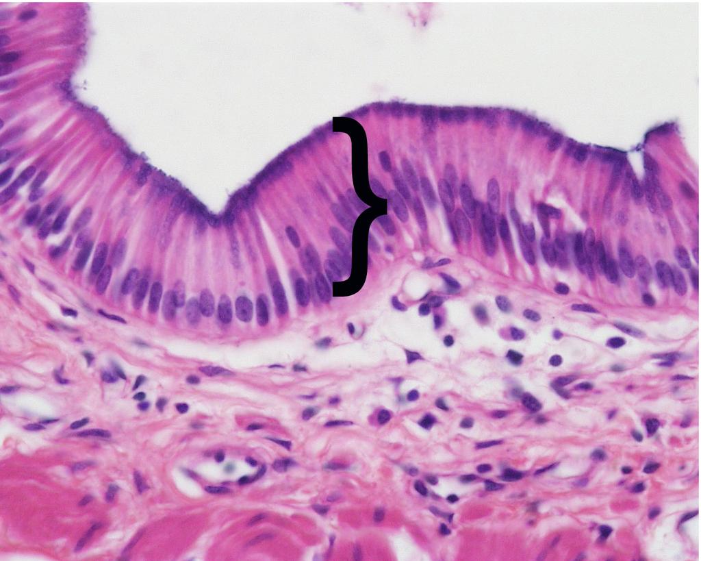 Mitosis Prelab Reading Fig. 1. Simple columnar epithelial cells lining the small intestine. The tall cells pictured in Fig. 1 form the lining of the small intestine in humans and other animals.