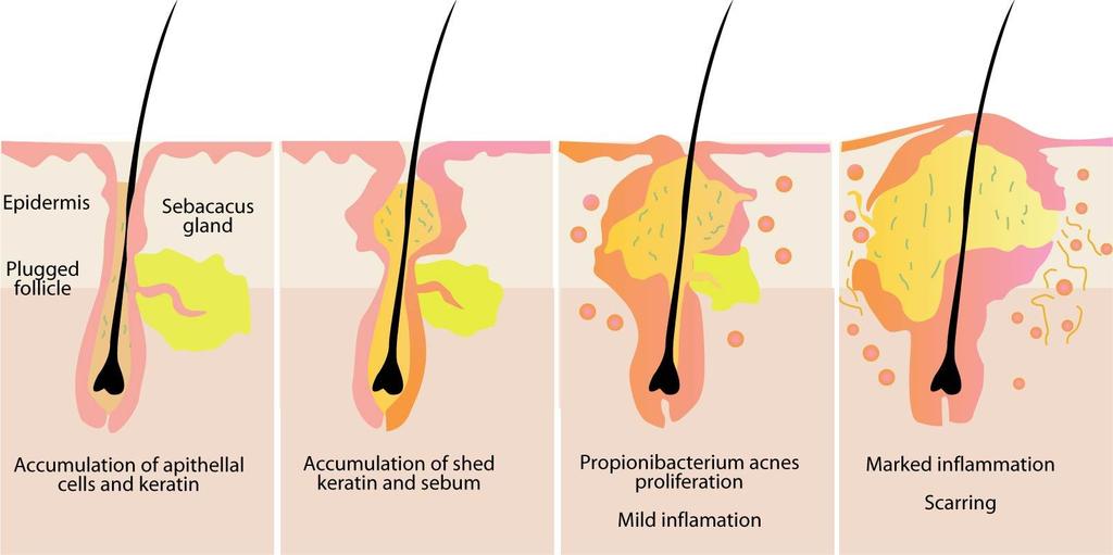 Dermis Dermis consists of connective tissue containing a protein called collagen.