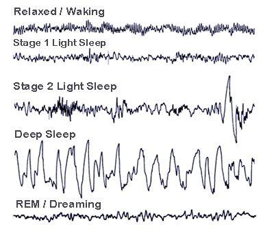 Your brain waves follow a pattern as you descend into deeper sleep.