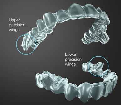 Single phase - invisalign 4,500.00 Total treatment cost 4,500.