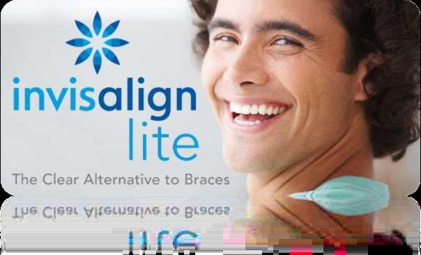 Rapid Orthodontics with Invisalign Lite Invisalign is an advanced means to straighten teeth, and it is only fitting that Invisalign Lite should carry on the great work this treatment has already