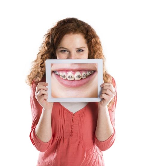ABOUT BRACES What Types of Braces Are Available? If braces are indeed the solution for you, the dentist or orthodontist will prescribe an appliance speci c for your needs.