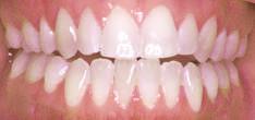 teeth. In growing patients, changes in jaw relationships can be achieved with regular treatment.