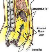 5 Types of fat distribution Visceral vs. Subcutaneous Upper ( apple ; android) vs.