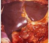Pancreas C. Regulation of Pancreatic Secretion 1.