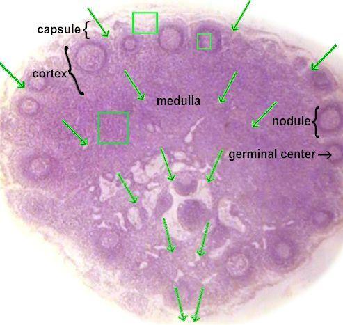 LYMPH NODE with