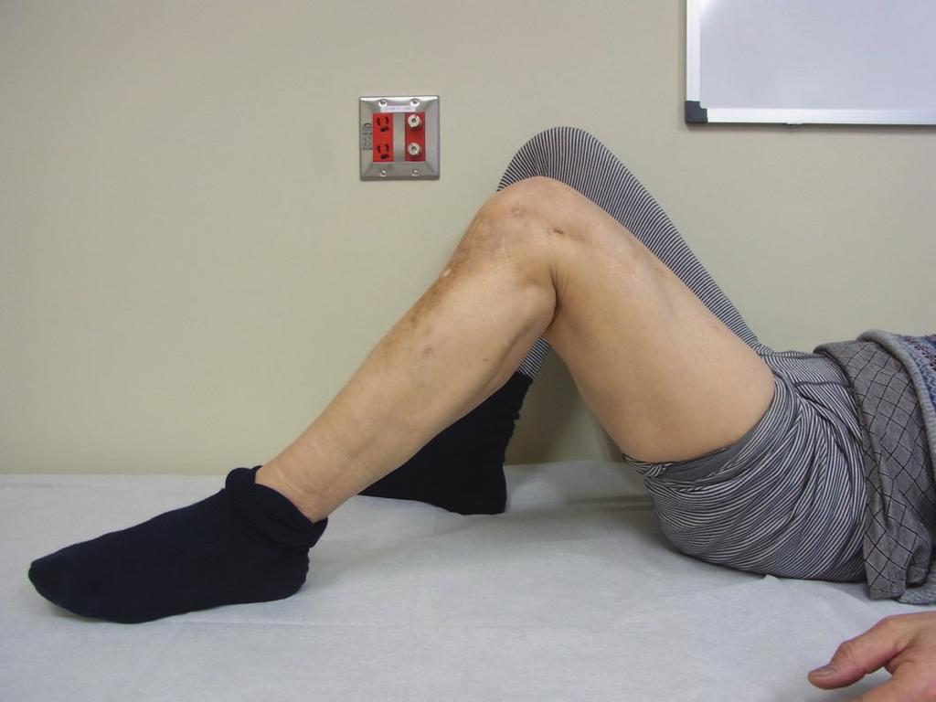 4 Case Reports in Orthopedics (a) (b) Figure 5: Last follow-up clinical photo. (a) Clinical photo in maximum flexion of the knee joint (about 100 ).