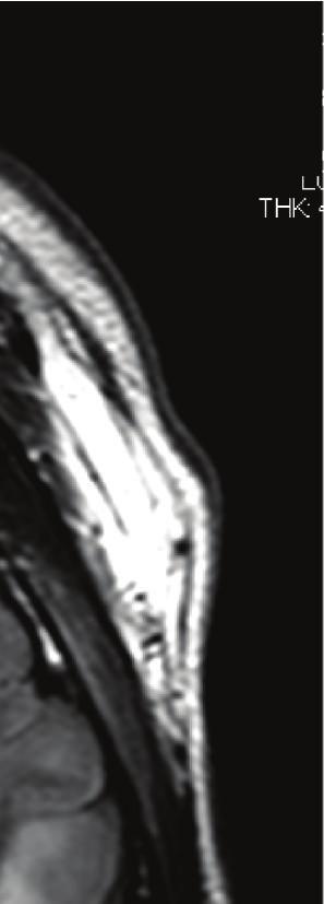 ) (a) (b) (c) Figure 2: MRI 