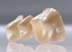 Design criteria High-quality materials as well as professional preparation and processing are the prerequisites for producing high-quality restorations, which fulfil the patient s requirements