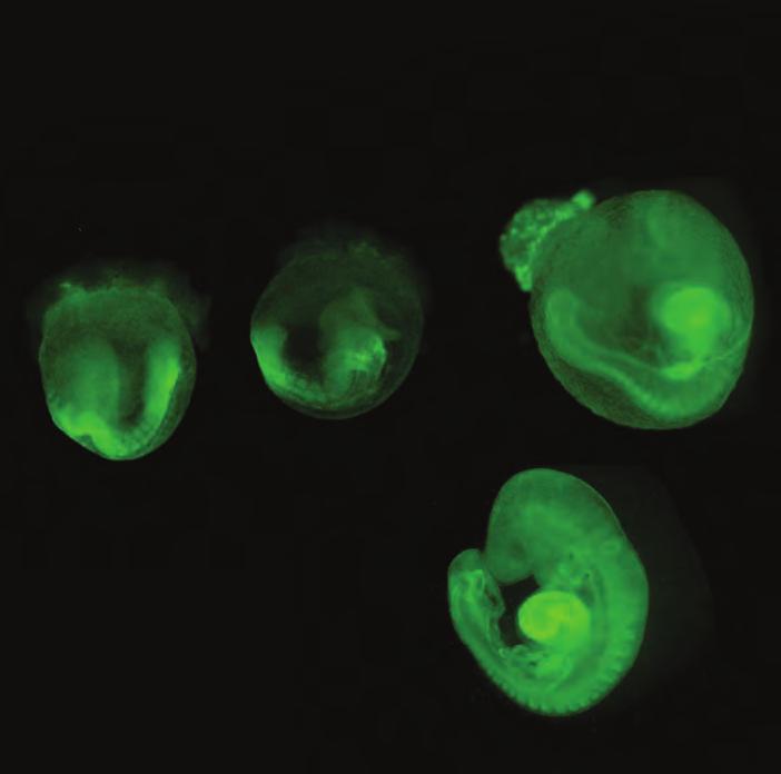 Microscopic view: Mouse embryos engineered to express green fluorescent protein in all cell membranes to more easily visualize the steps of neural tube closure recommended that every woman of