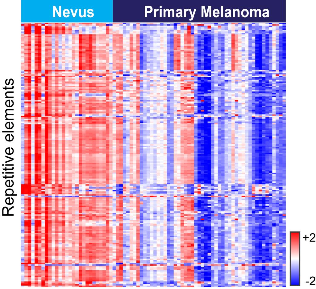 Supplemental Figure 3. Differentially Expressed Endogenous Elements between Melanoma vs. Nevus Subsets Figure S3.