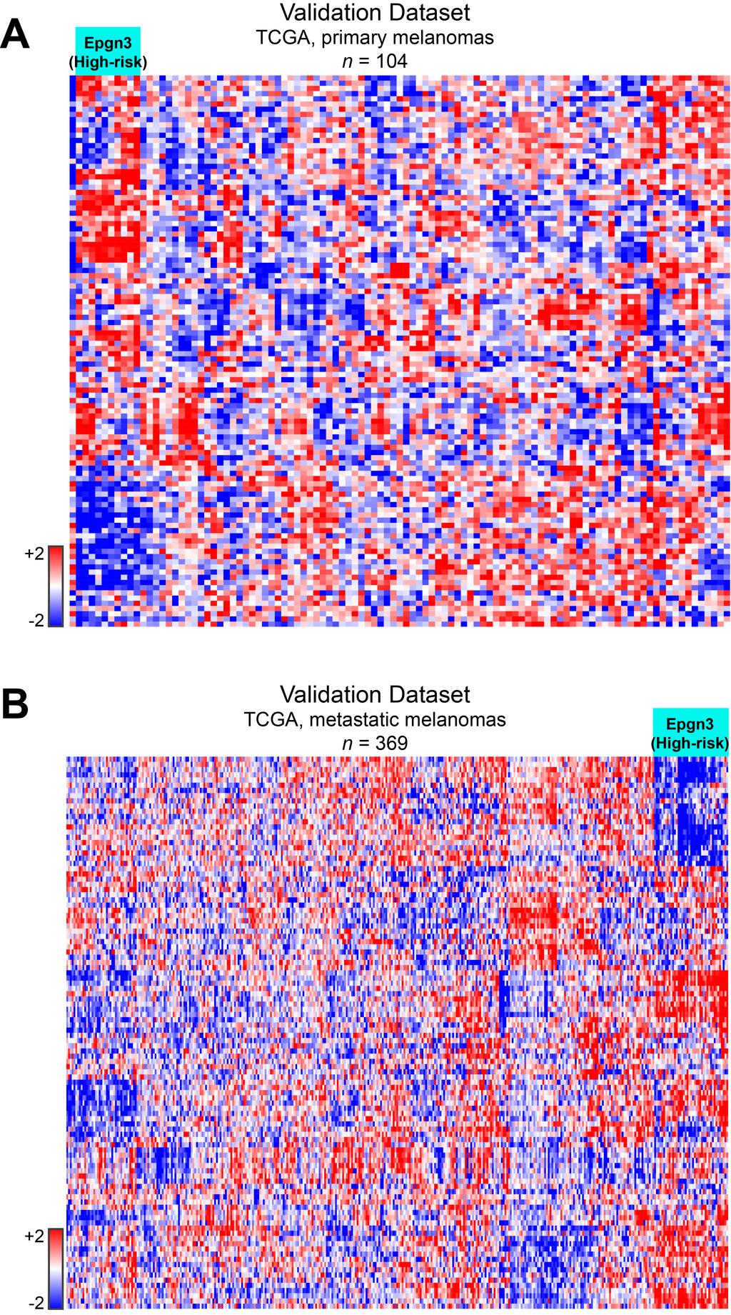Supplemental Figure 4. Identification of the Epgn3 (high-risk) Cluster in Independent Melanoma Datasets Figure S4. TCGA dataset of melanomas (n = 473) were downloaded from https://cancergenome.nih.