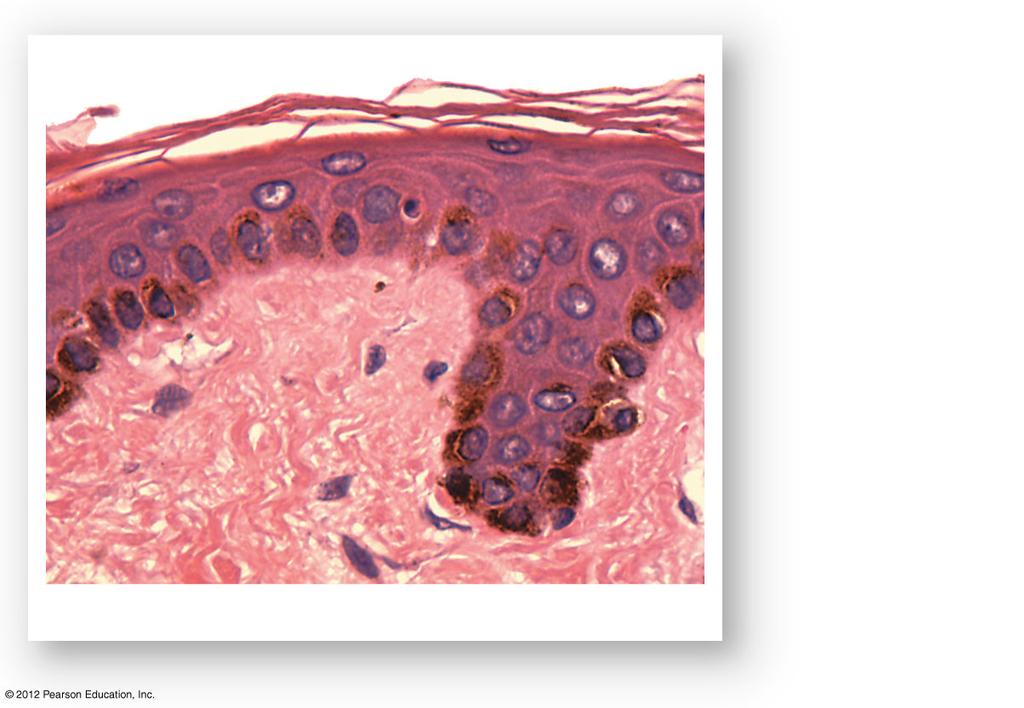 Figure 5-5 Melanocytes Melanocytes in stratum basale
