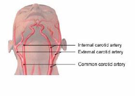 Carotid Artery Carotid