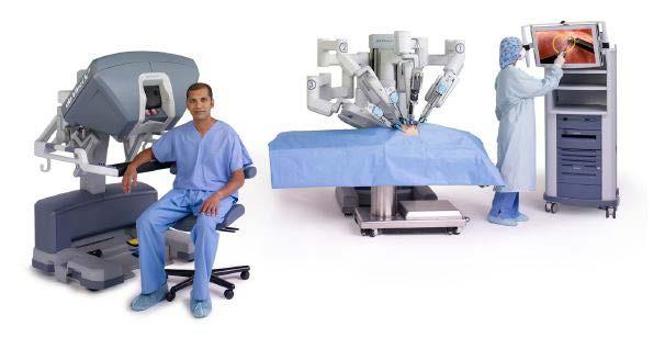 For most patients, da Vinci Prostatectomy offers numerous potential benefits over open prostatectomy including: Shorter