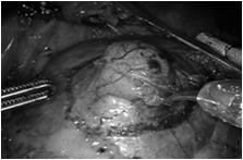 Real time anatomy identification better than the naked eye allows Enhance visual feedback to make real-time clinical decisions Create foundational technologies for true image-guided surgery
