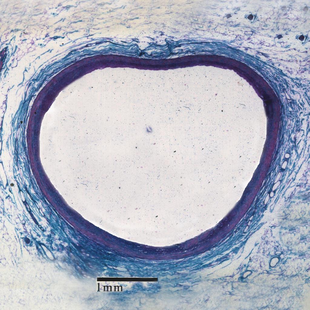 Figure 1 Layers of a Typical Artery close-up of Intima intima Photomicrograph courtesy of PDAY Funded by the National Heart, Lung, and Blood Institute