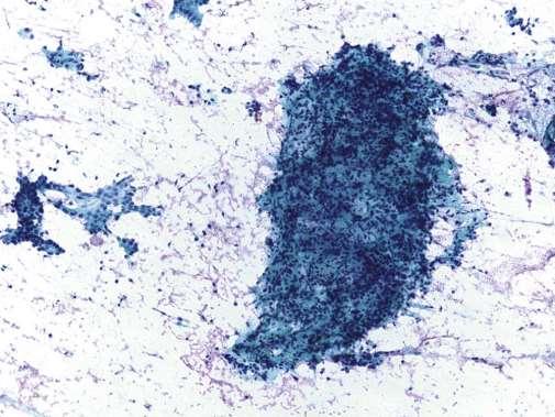 Cytological Features of Chronic