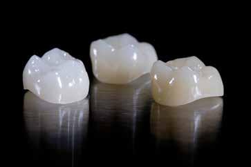 Empress CAD Multi Blocks are available in the five most popular A D and two Bleach BL shades, as well as in 3 sizes. They are ideal for fabricating full and partial crowns as well as veneers.