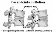 moving some object Sudden acute & chronic repetitive stress Avoid Exercises Pathomechanics & injury