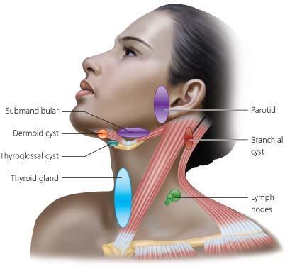 Common neck lumps and locations Carotid bulb Roland N, and Bradley