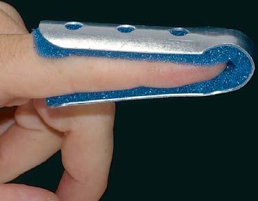 FINGER COTS Align the finger with a fracture of the distal or middle phalanx. 6 pack. (Sizing: Measure finger length).