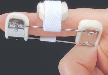 Large 3 1 4 (83mm) 13/8 (35mm) BUNNELL MINI-MODIFIED SAFETY FINGER PIN Reduces PIP flexion contractures.