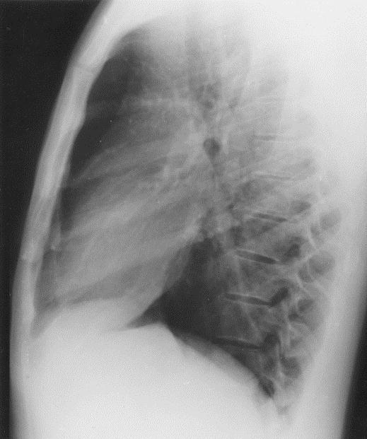 How do you interpret the chest X rays? 2.