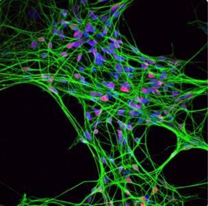 Background Many neuronal phenotypes have been derived from human ipscs