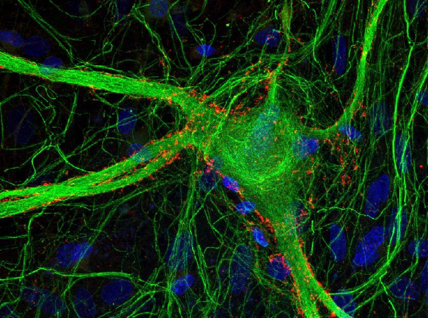 Ⅲ Synaptophysin Hoechst 33258 50mm These neurons were similar in