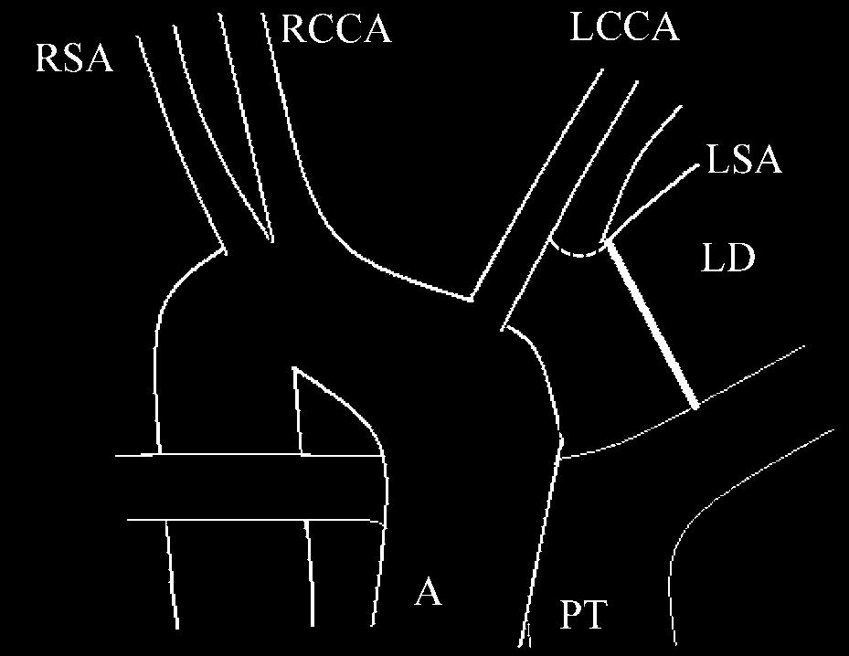 during embryologic development of the aortic segment [6] (Fig. 5).