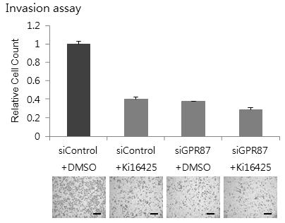 Supplementary Figure 10. Measuring MMP9 expression after GPR87 knockdown using RTqPCR assay. Scale bar, 200μm.