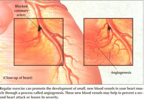 Since myocardial cells do not reproduce, the area of necrosis is gradually replaced by fibrous,
