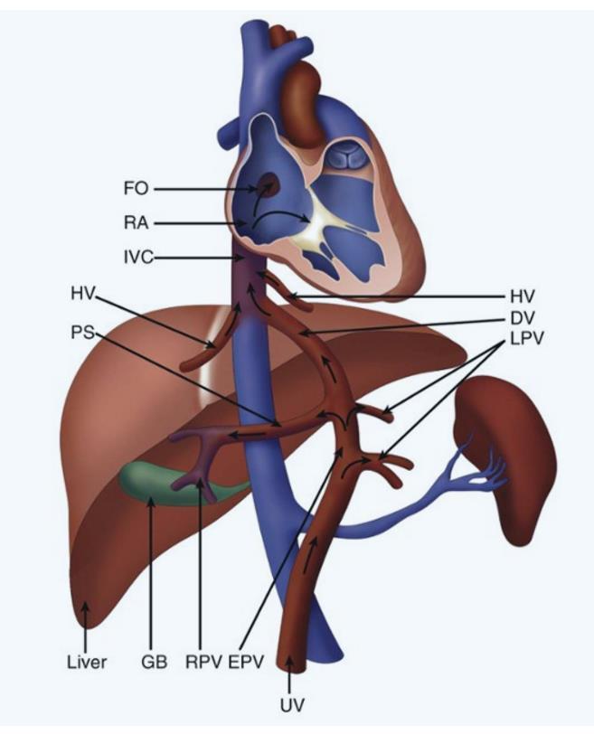 The fetal circulation Oxygenated blood from placenta streams to left heart High pulmonary