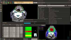 console while the patient is on the table. To enhance accurate delineation of soft tissue, our MR simulation platform is designed for integration in the radiotherapy workflow.