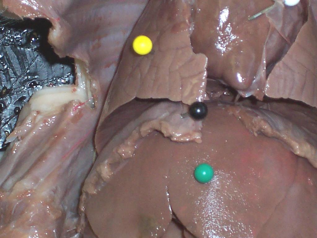 Yellow: Right Lung; Black: Diaphragm;