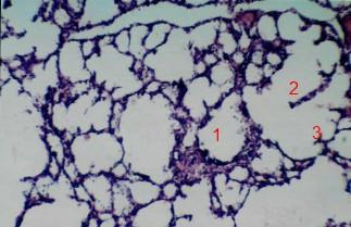 X5 1. Alveoli.