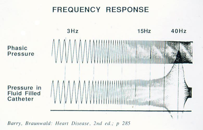 A) Resolution of a Normal Ventricular Pressure Tracing into ist first 10 Harmonics by Fourier Analysis B) Effect