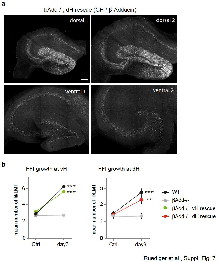 Supplementary Figure 7. Local rescue of β-adducin expression and FFI growth in vh or dh granule cells of β-adducin -/- mice.