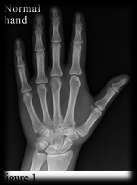 Surgery of Hand