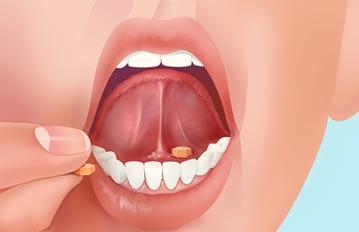 Sublingual Opioids Cooperation required No need for painful injections