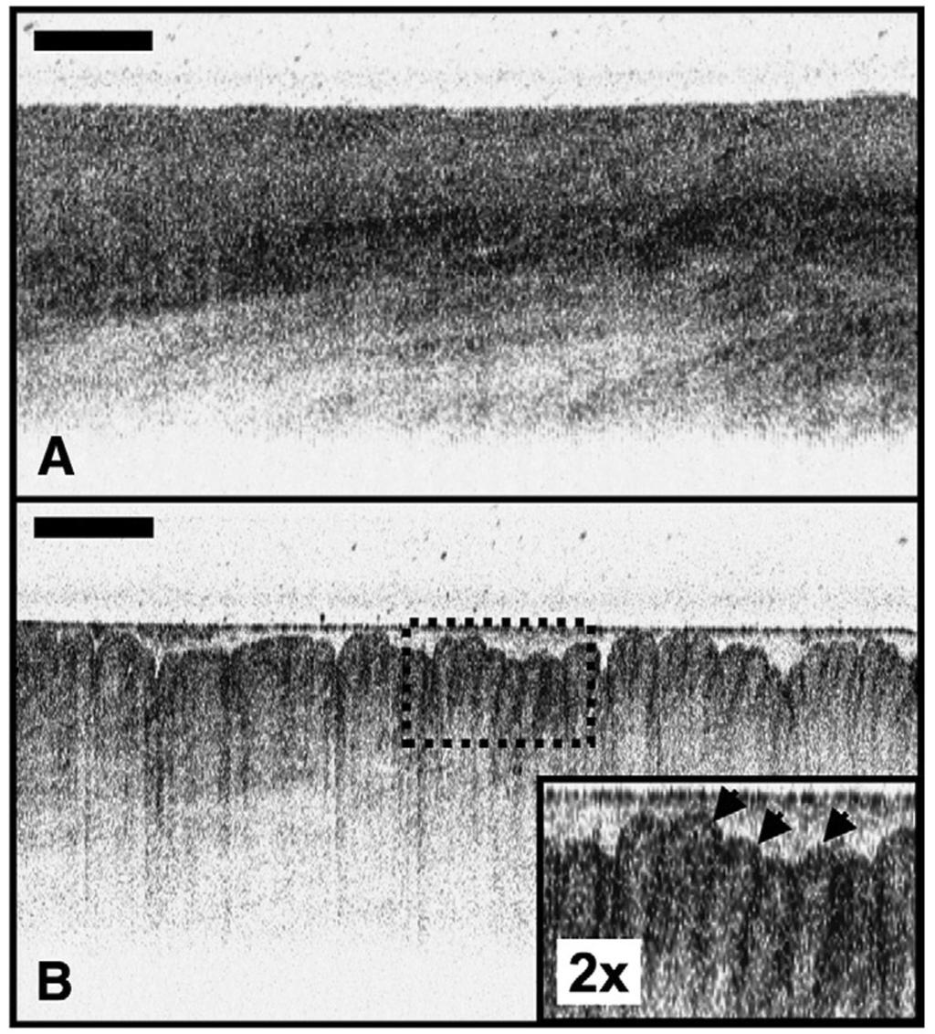 Evans et al. Page 8 Figure 1. Images of nonmetaplasic epithelium. A, OCT image of squamous epithelium demonstrates a horizontally layered architecture.