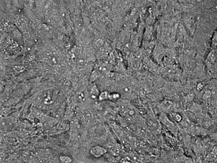 Phase-contrast images of cultured neonatal mouse cardiomyocytes at 1, 3 and 6 days in culture. Cultures were plated in a 24-well plate at a density of 5 x 10 5 cells per well.