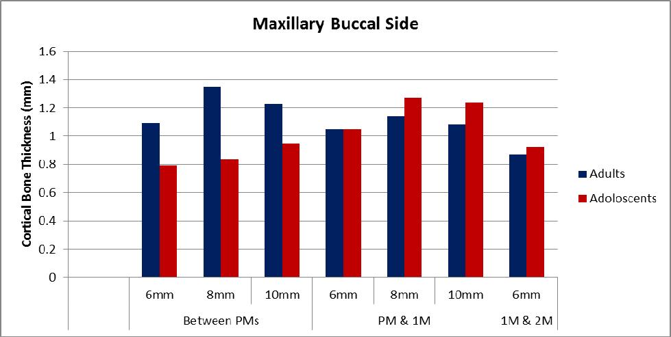 Higher cortical bone thickness is seen in adult mandibular buccal cortex region between first and second molars and at 10mm from the CEJ, followed by maxillary buccal region and maxillary palatal