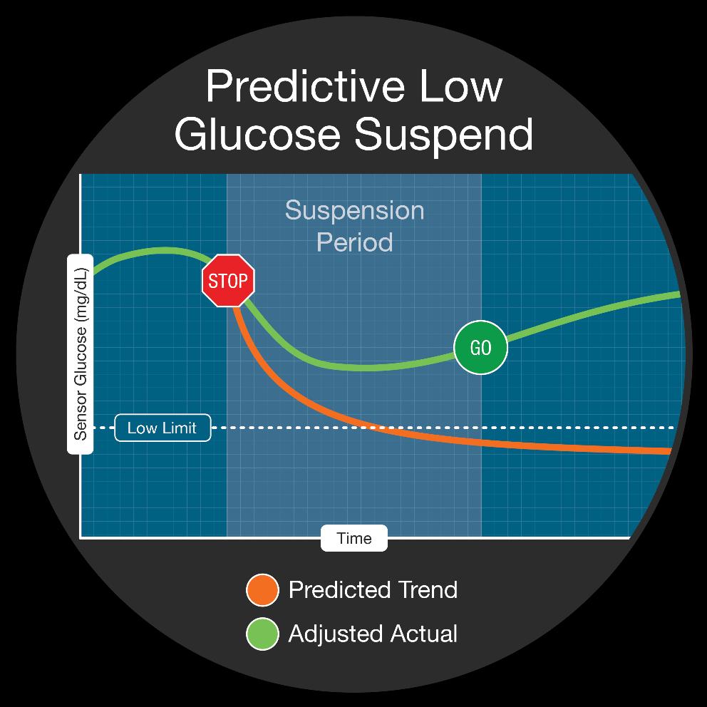 : REDUCING HYPOGLYCEMIA t:slim X2 with predictive low-glucose suspend algorithm 1 ;