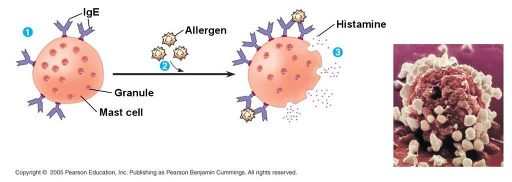 ALLERGIES The next time the allergen enters the body, it binds to mast cell (with associated IgE antibodies) Mast cells release histamine which causes vascular changes